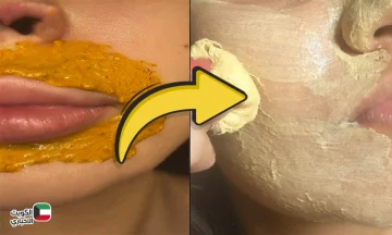 إزالة السواد حول الفم بمكون بسيط في مطبخك بوصفة مجربة وفعالة