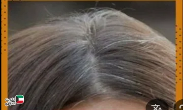 كيفية صبغ شيب الشعر بوصفات فعالة وآمنة؟ مع أقوي وصفة مجربة لاخفاء الشيب