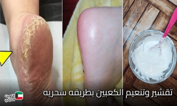 كعبك هينور.. تقشير وتنعيم الكعبين بطريقه سحريه وبمكونات طبيعيه مش هتروحي لكوافير تانى