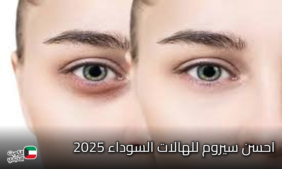 هالاتك هتختفي في اسبوع واحد.. احسن سيروم للهالات السوداء 2025 من قبل خبراء الاطباء